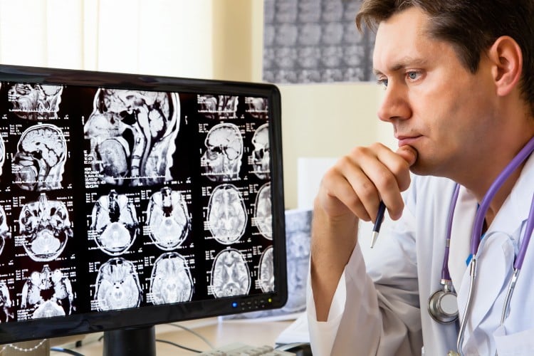 doctor analyzes x ray of traumatic brain injury victim